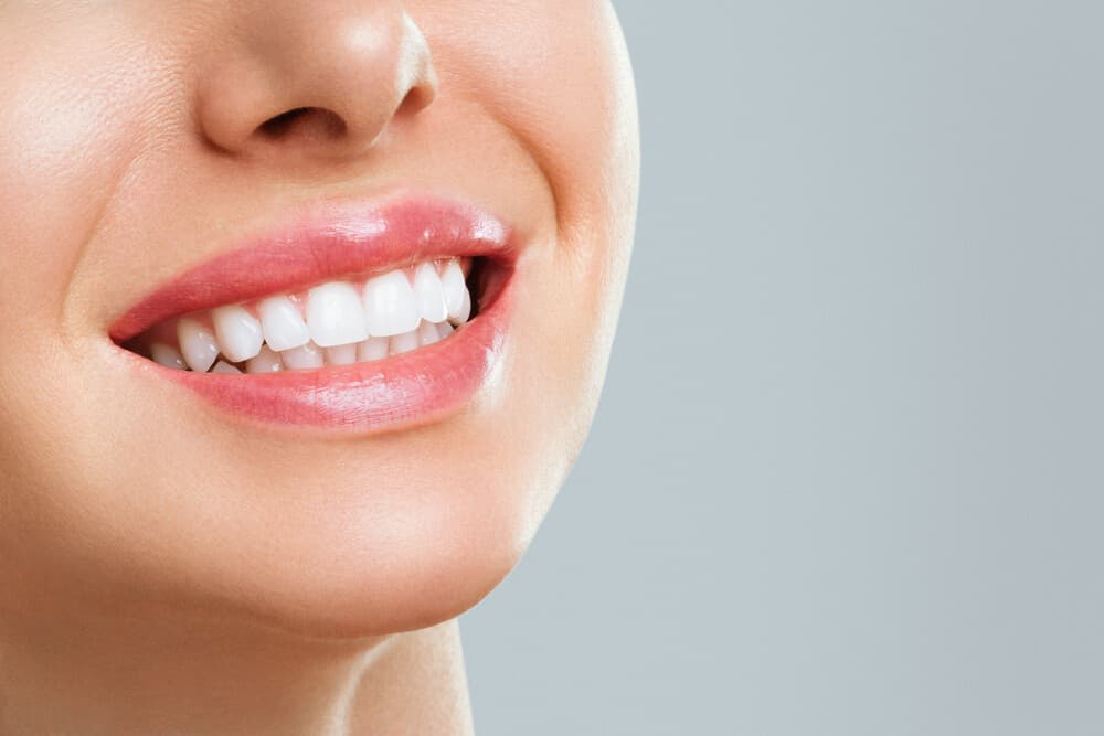 gummy smile atlanta cosmetic dentistry